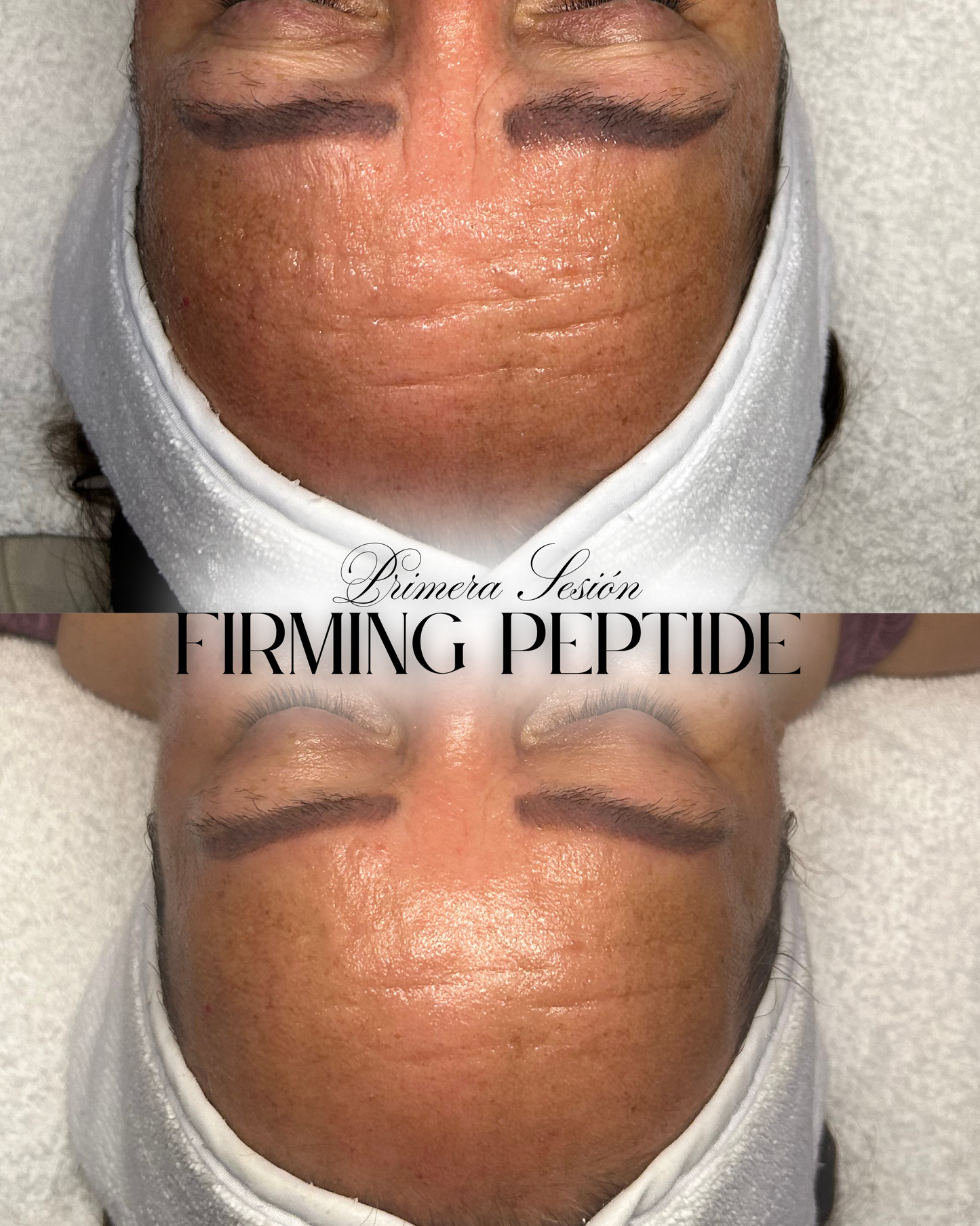 Masterclass de Limpieza Facial Profesional y Aparatologia Básica | NUEVO 2026