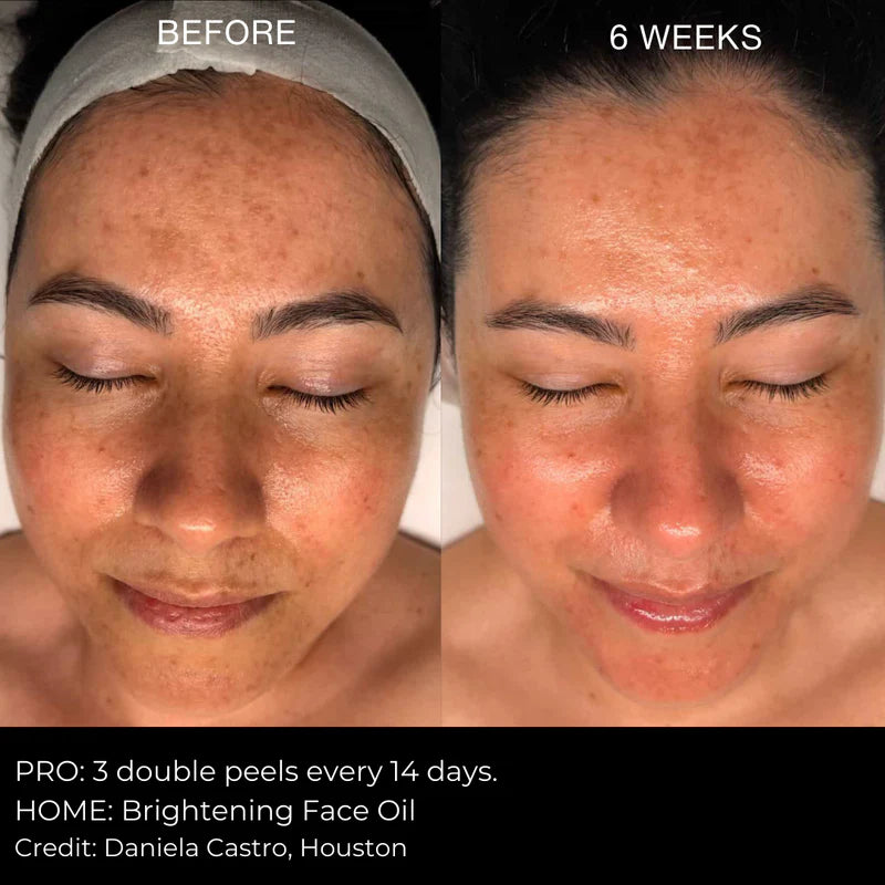Peeling Avanzado ⚗️ Peeling Natural Mr. Lulú