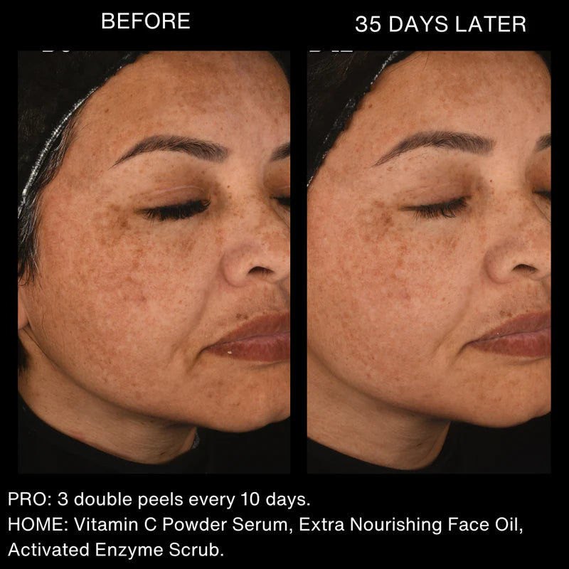 Peeling Avanzado ⚗️ Peeling Natural Mr. Lulú