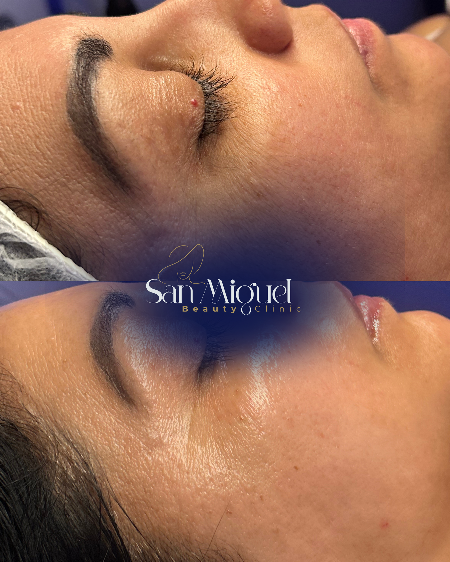 Seminario de Limpieza Facial Profunda y Tecnología Estética